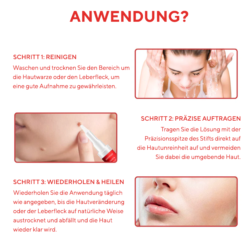 Fivfivgo® Stift zum Entfernen von Hautflecken und Leberflecken