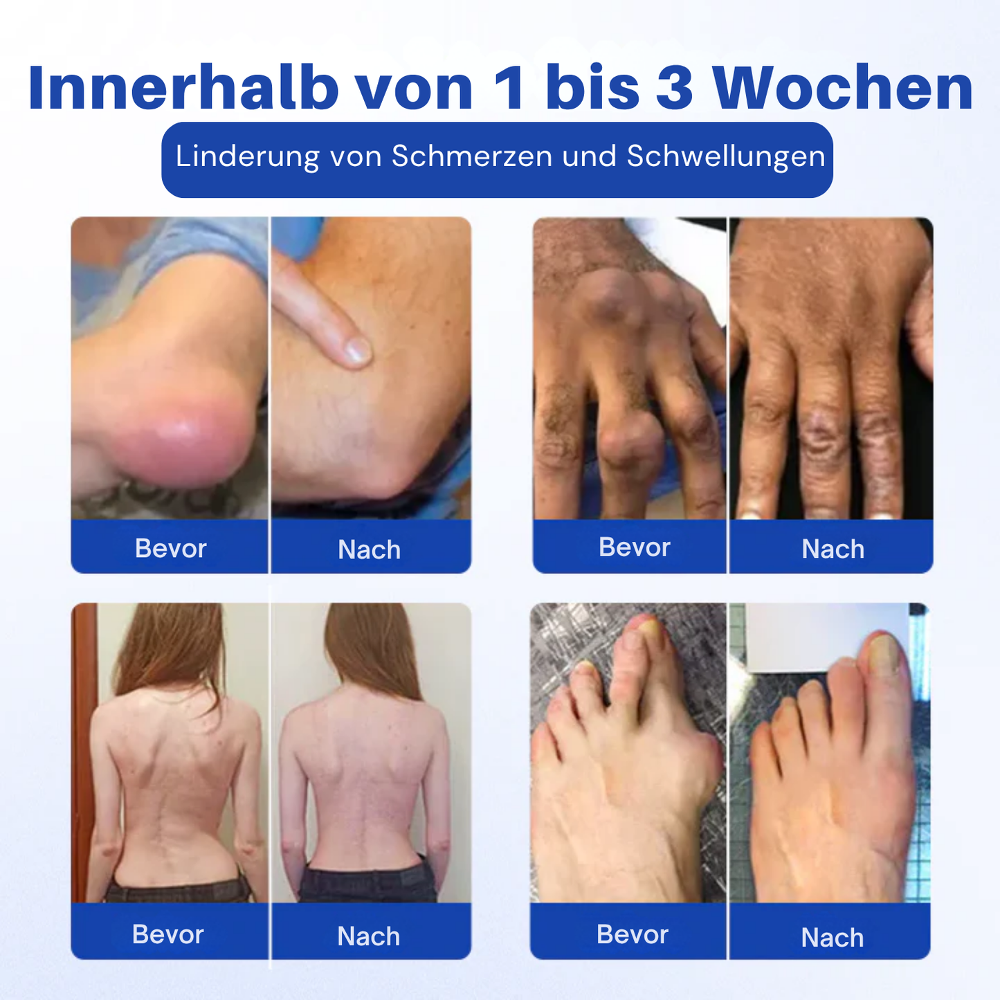 NovaRX® BPC-157 Gelenk & Knochen Reparieren Roll-On Gel