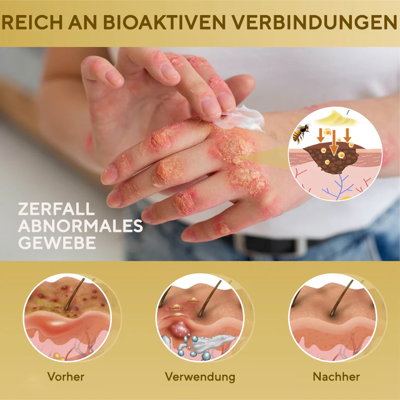 Fivfivgo® Condense Mellifera Gift Hautregenerierende Creme