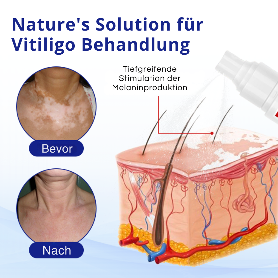 Fivfivgo® VitiClear Kräuter Spray