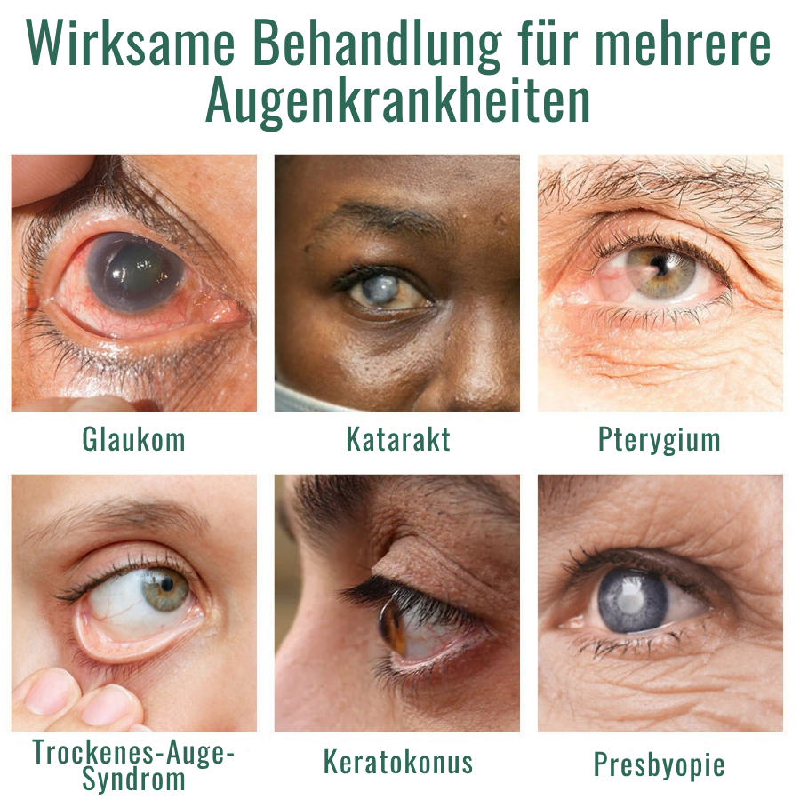 Fivfivgo® Nano Augentropfen-Serum 👩‍⚕️ Empfohlen vom Royal College of Ophthalmologists (Geeignet für Presbyopie, trockenes Auge, Glaukom und Katarakt)
