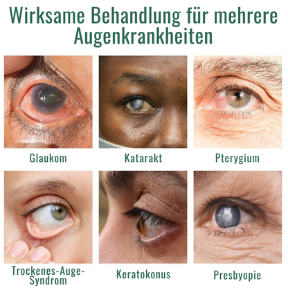 Fivfivgo® Nano Augentropfen-Serum 👩‍⚕️ Empfohlen vom Royal College of Ophthalmologists (Geeignet für Presbyopie, trockenes Auge, Glaukom und Katarakt)
