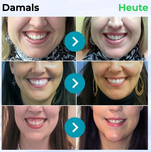 Fivfivgo® Bienengift Behandlung Pulver zum oralen Gebrauch