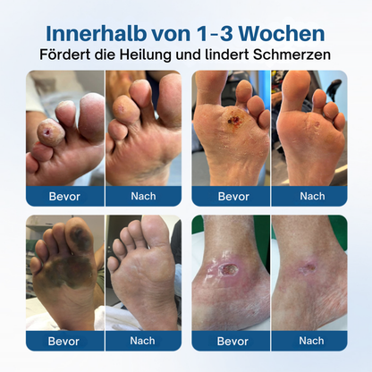 Fivfivgo® AngioVita Diabetiker-Pflegespray