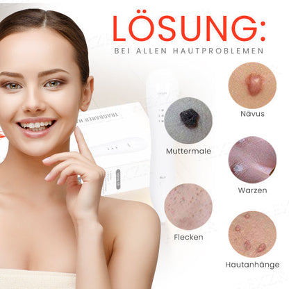 Fivfivgo™ Tragbarer Hautpflege-Laserstift