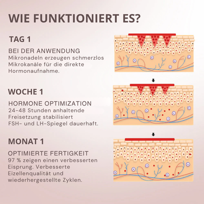 Oveallgo® FertiliPatch Mikronadeln Fruchtbarkeit Verbesserung System PRO