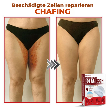 Fivfivgo® MikroNadel Botanisch Haut Tag Entfernung Patch 🇩🇪 Hergestellt in der Deutschland