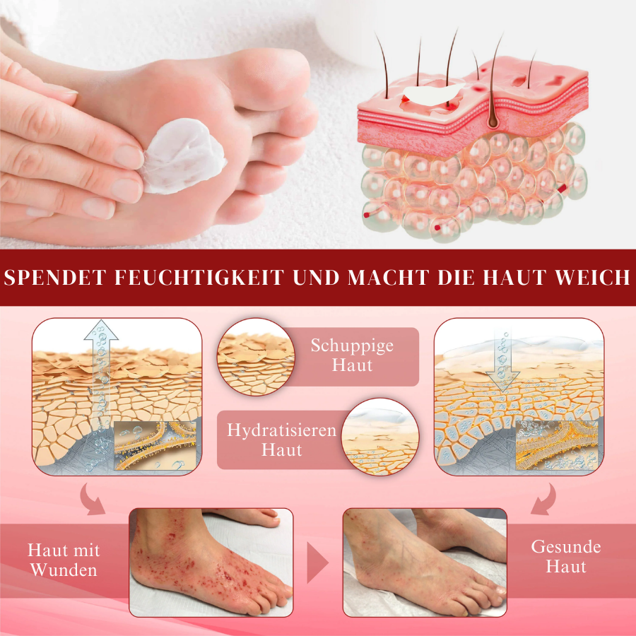 Cvreoz® GlucoseGuard Haut-Rettungs-Creme