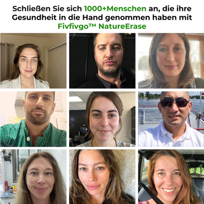 Fivfivgo® NatureErase Sofortige Maulwurf- und Fleckencreme