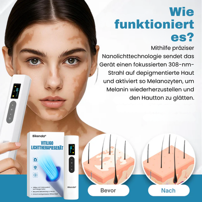 Bikenda® Vitiligo-Lichttherapiegerät