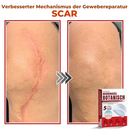 Fivfivgo® MikroNadel Botanisch Haut Tag Entfernung Patch 🇩🇪 Hergestellt in der Deutschland