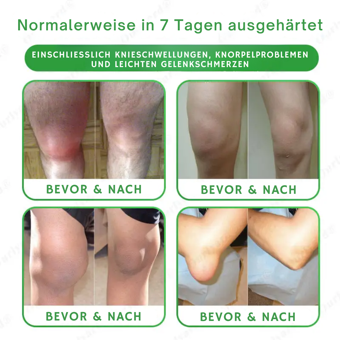 NovaRX® Fortschrittliches Magnesium & Emu-Öl Massage-Schmerzlinderungscreme