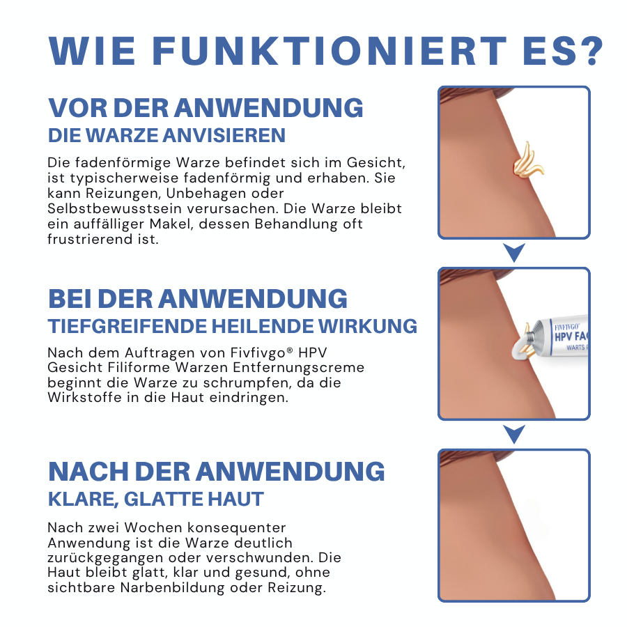 Fivfivgo® HPV Gesicht Filiforme Warzen Entfernungscreme