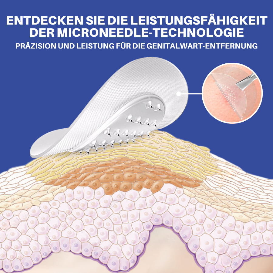 Fivfivgo® Mikronadel HPV Genitalien Warzen Entfernung Patch
