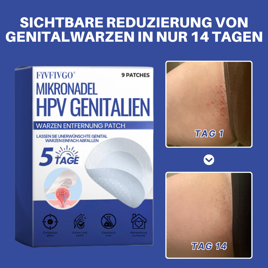 Fivfivgo® Mikronadel HPV Genitalien Warzen Entfernung Patch