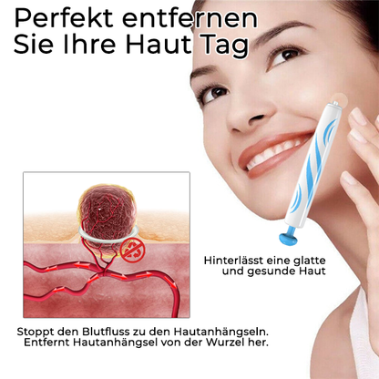 Fivfivgo™ Stift zur Entfernung von Hautmarkierungen zu Hause
