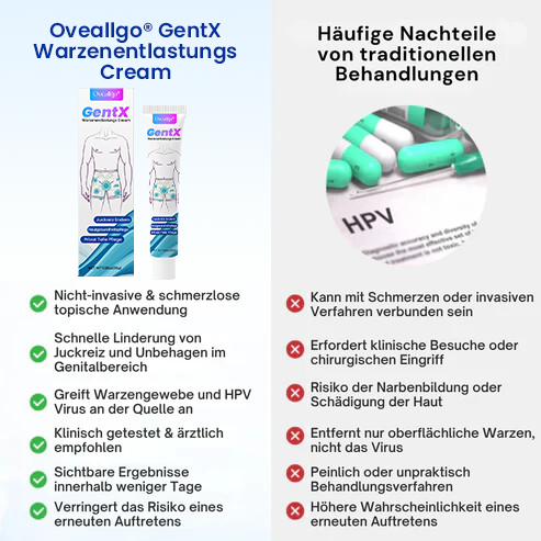 Oveallgo® GentX Warzenentlastungs Creme
