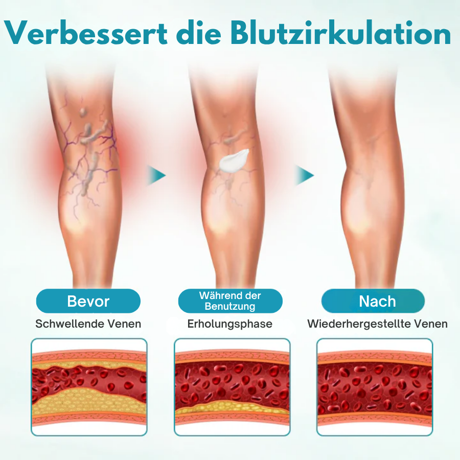 Fivfivgo® VeinEase Beruhigende Creme