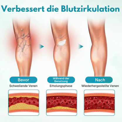 Fivfivgo® VeinEase Beruhigende Creme