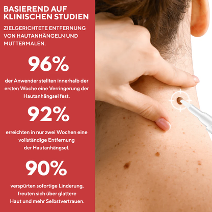 Fivfivgo® Stift zum Entfernen von Hautflecken und Leberflecken