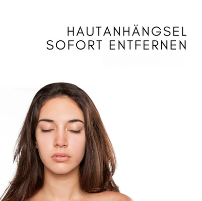 Fivfivgo™ WipeOff Tags & Maulwurfentferner