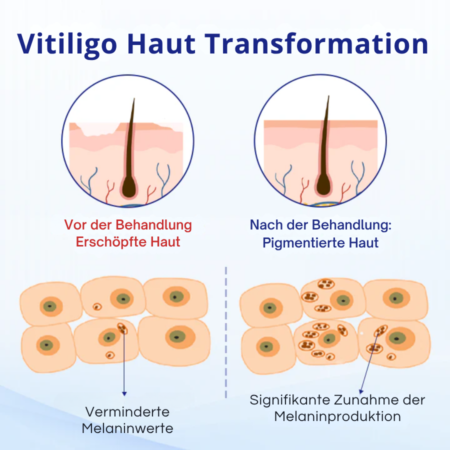 Fivfivgo® VitiClear Kräuter Spray