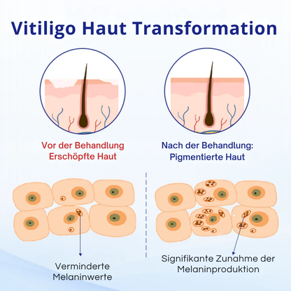 Fivfivgo® VitiClear Kräuter Spray