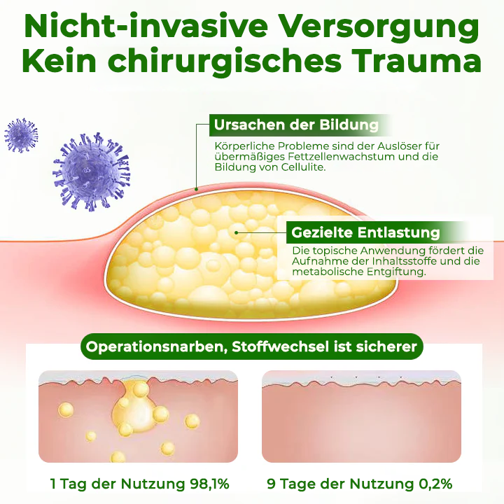Fivfivgo® KnotAway Lipom-Entfernung Creme