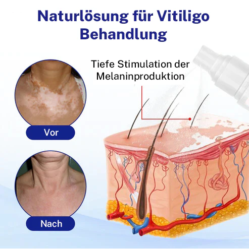 Oveallgo® Evenora Kräuterspray