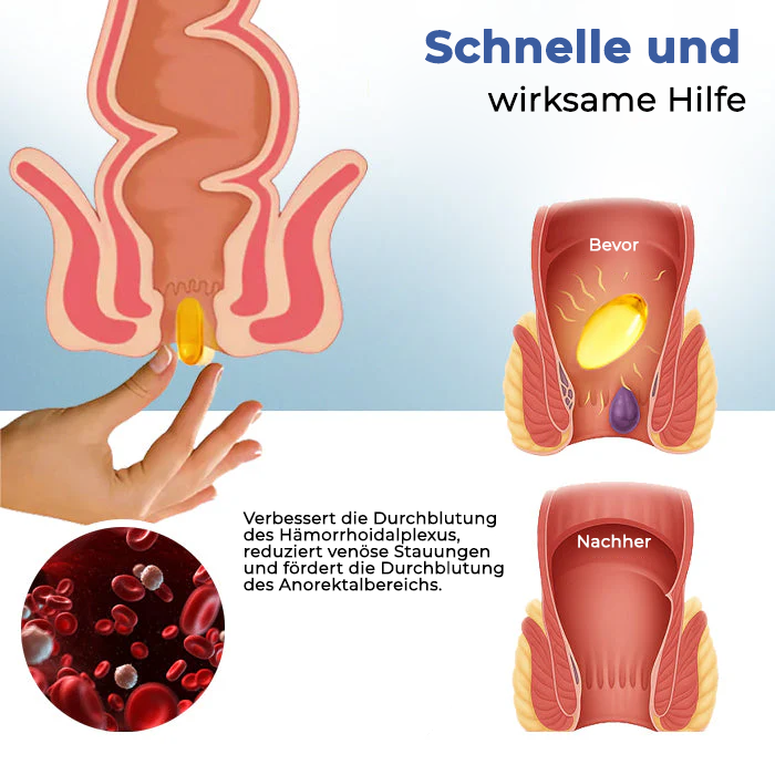 Fivfivgo® Natürliche Hämorrhoiden-Kapseln