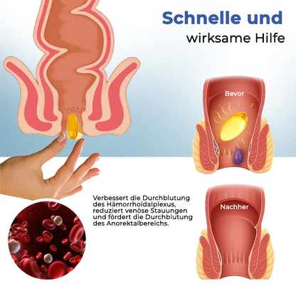 Fivfivgo® Natürliche Hämorrhoiden-Kapseln