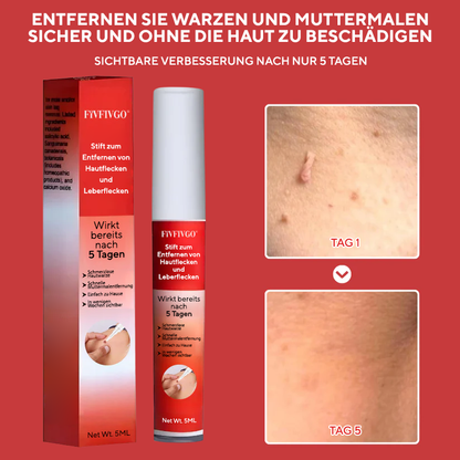 Fivfivgo® Stift zum Entfernen von Hautflecken und Leberflecken