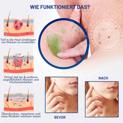 Fivfivgo® NatureErase Sofortige Maulwurf- und Fleckencreme