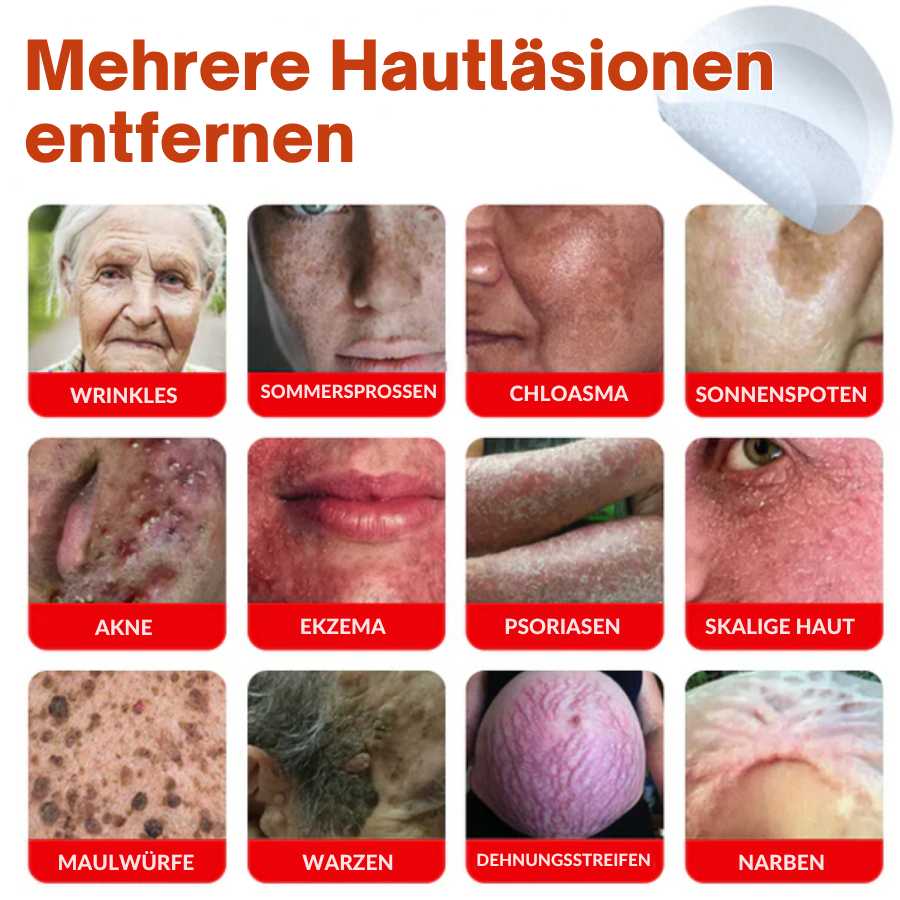 Fivfivgo® MikroNadel Botanisch Haut Tag Entfernung Patch 🇩🇪 Hergestellt in der Deutschland