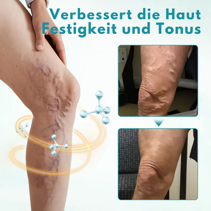 Fivfivgo® VeinEase Beruhigende Creme