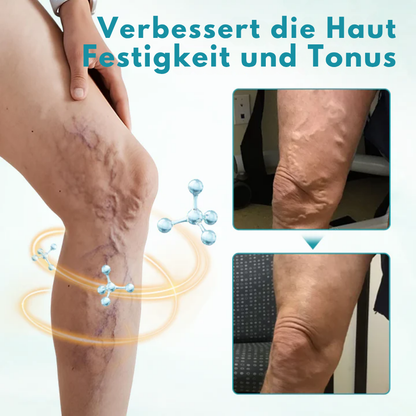 Fivfivgo® VeinEase Beruhigende Creme