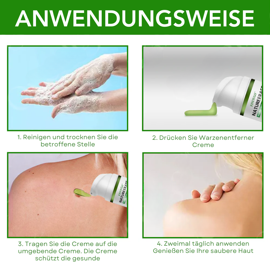 Fivfivgo® NatureErase Sofortige Maulwurf- und Fleckencreme