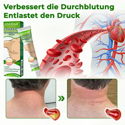 Fivfivgo® KnotAway Lipom-Entfernung Creme