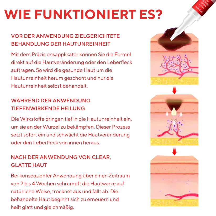 Fivfivgo® Stift zum Entfernen von Hautflecken und Leberflecken