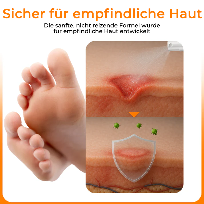 Cvreoz® VenHeal Bienengift Diabetiker-Wundspray