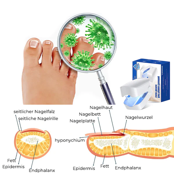 Fivfivgo™ Revolutionäres hocheffizientes Lichttherapiegerät für Zehennagelkrankheiten