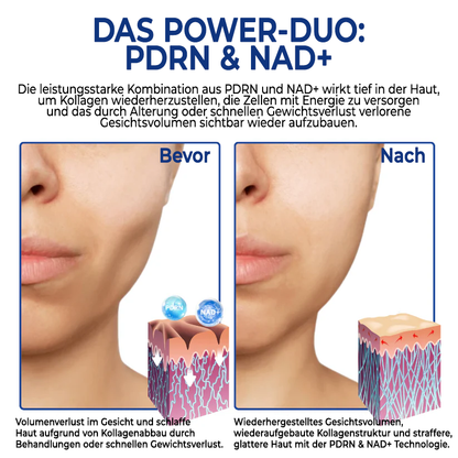 Fivfivgo® PDRN-NAD+ Cica Reedle Schuss Serum