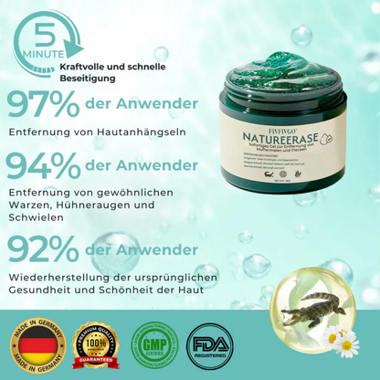 ✅ Offizieller Laden: Fivfivgo® NatureErase Sofortiges Gel zur Entfernung von Muttermalen und Flecken