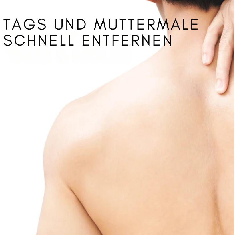 Fivfivgo™ WipeOff Tags & Maulwurfentferner