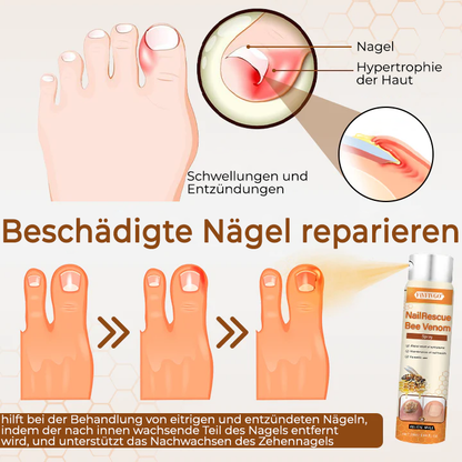 Fivfivgo® NailRescue Bienengift-Spray