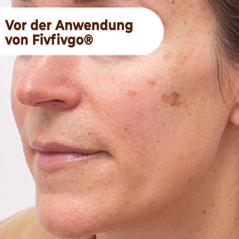 Fivfivgo® Herbal Spots Peel-Off-Gesichtsmaske