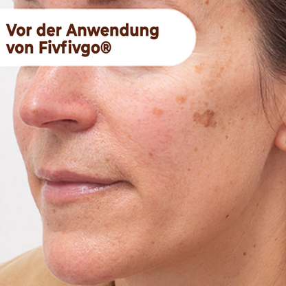 Fivfivgo® Herbal Spots Peel-Off-Gesichtsmaske