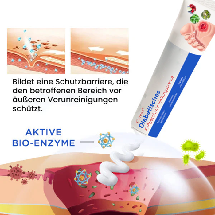 Cvreoz® Diabetisches Fußgeschwür  Heilungscreme