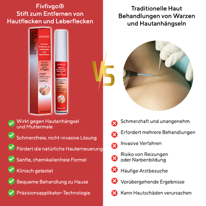 Fivfivgo® Stift zum Entfernen von Hautflecken und Leberflecken