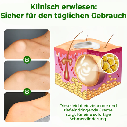 Fivfivgo® KnotAway Lipom-Entfernung Creme